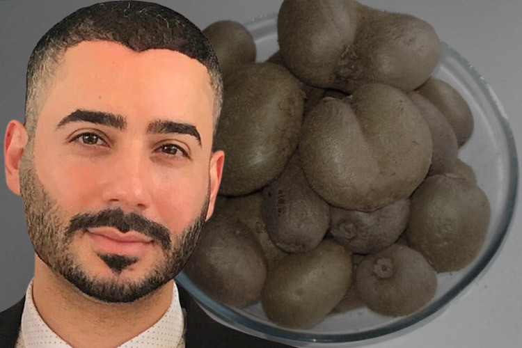 Ünlü doktor uyardı: O meyveyi yerken çok büyük bir hata yapıyorsunuz!