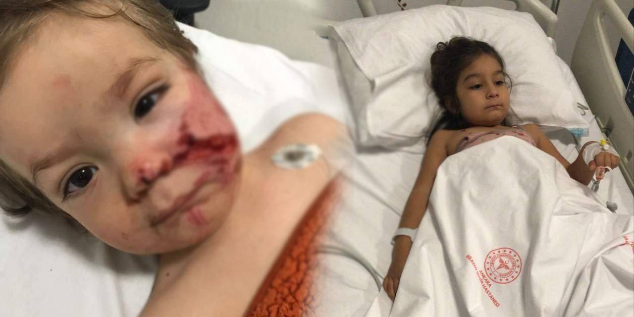 2 çocuk yaralanmıştı: Pitbull cinsi köpeğin sahibi tutuklandı